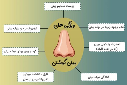 مهم ترین ویژگی های بینی های گوشتی