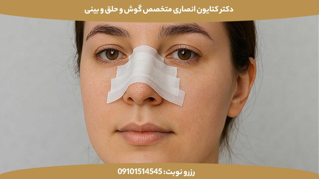 مدت زمان چسب زدن بینی بعد از عمل