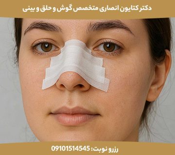 مدت زمان چسب زدن بینی بعد از عمل