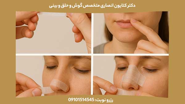 نحوه صحیح چسب زدن به بینی