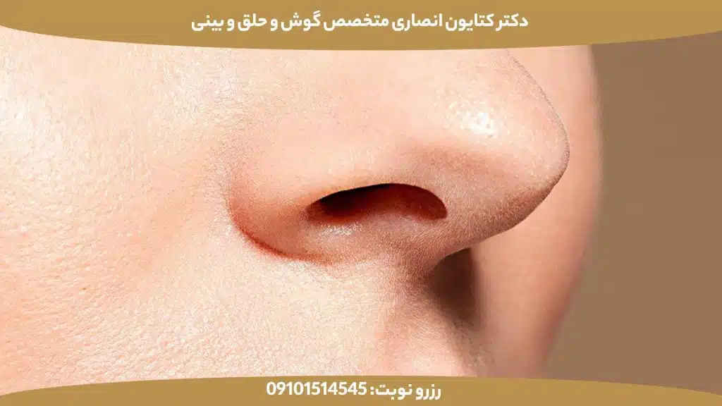 عمل بینی طبیعی یعنی چه؟ چگونه نتیجه‌ای طبیعی داشته باشیم؟