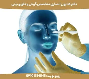 رینوپلاستی لیزری چیست؟ | بررسی واقعیت‌ها، مزایا و محدودیت‌های جراحی بینی با لیزر