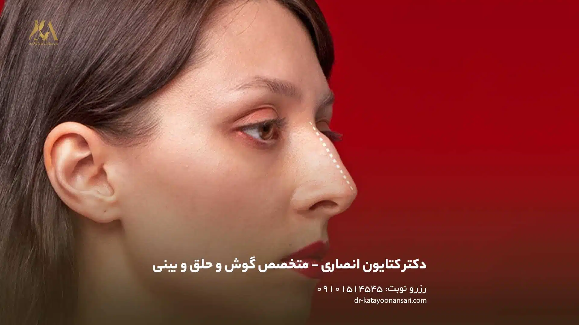 بینی استخوانی