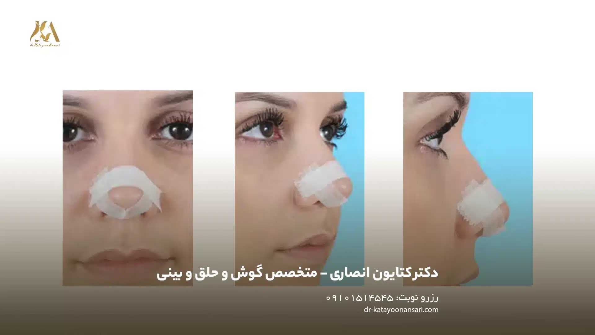 چگونه چسب را درست بزنیم؟