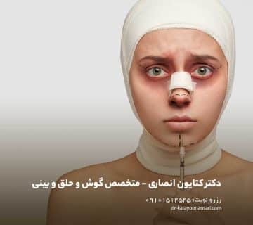 علت کبودی زیر چشم بعد از عمل بینی | علل، درمان و مدت زمان بهبود