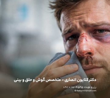 شکستگی بینی