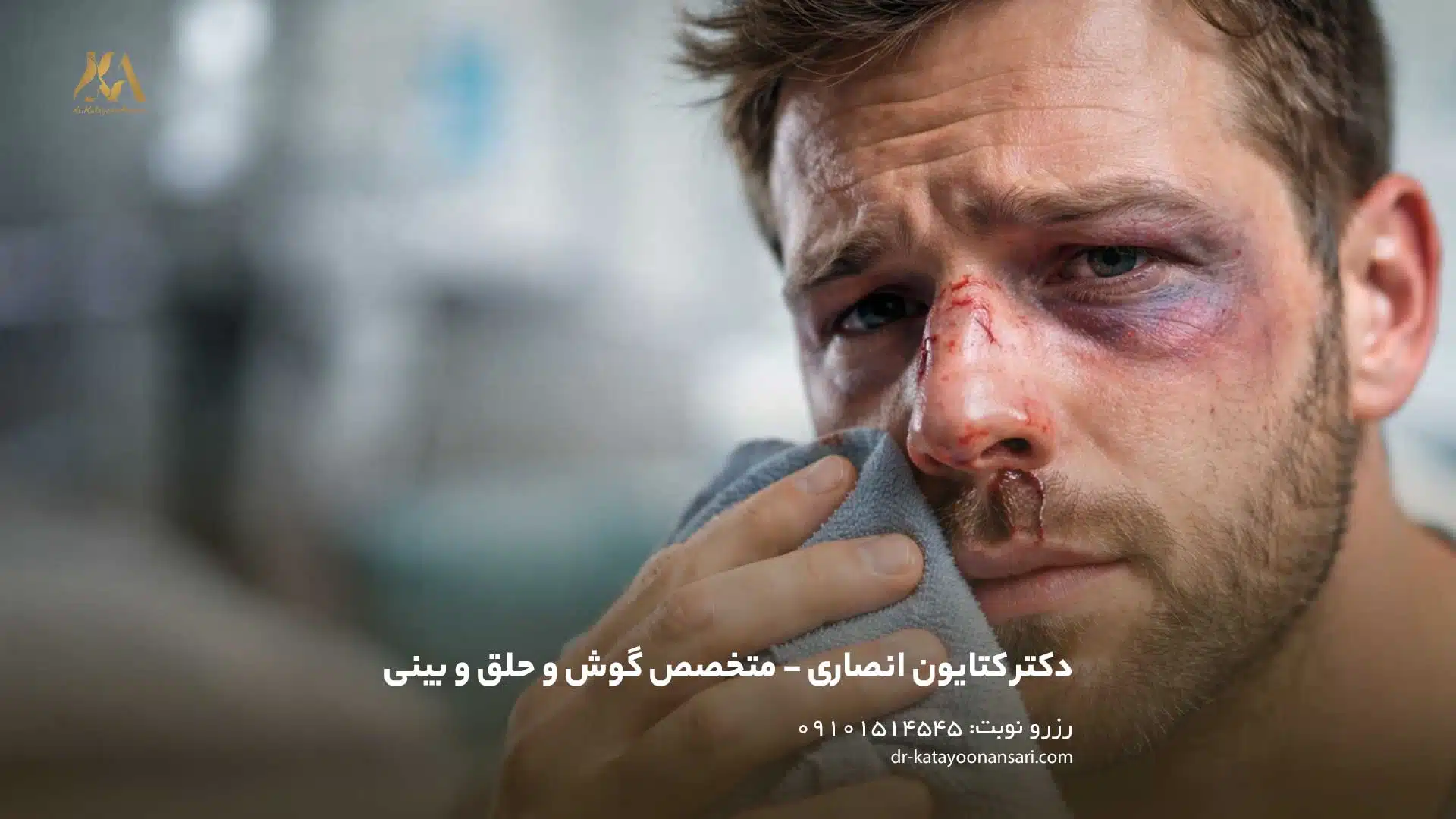 شکستگی بینی