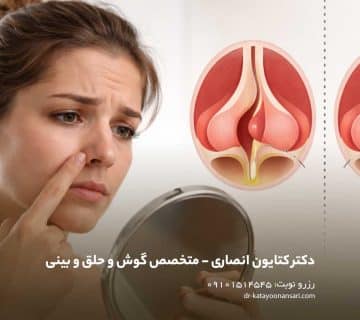 انحراف بینی یا انحراف تیغه بینی