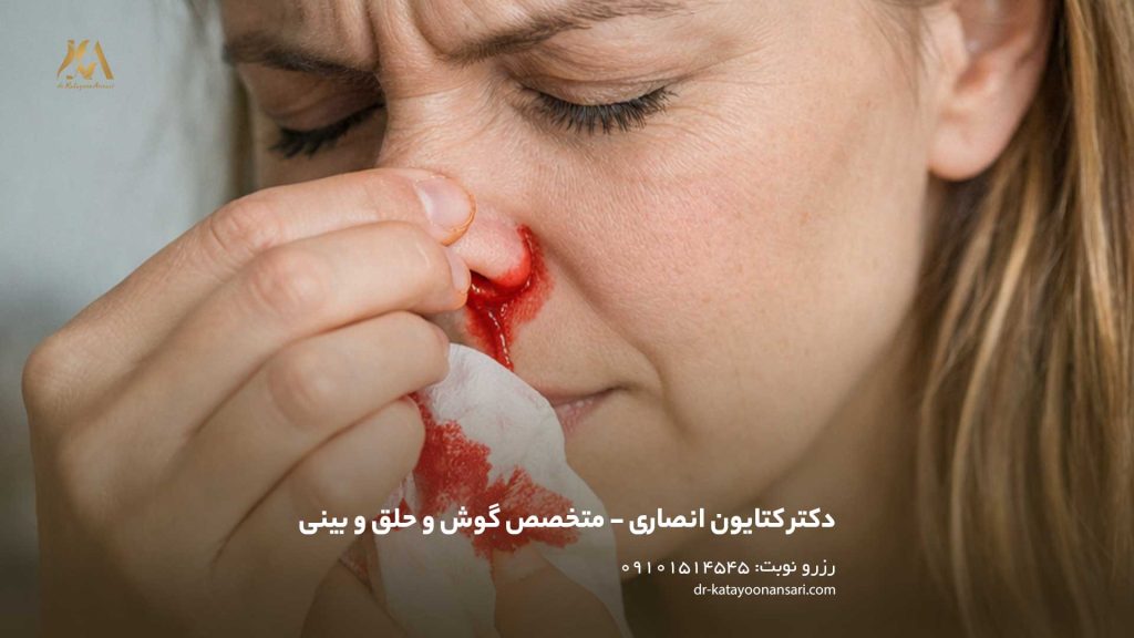 خون‌دماغ، خونریزی بینی یا نام علمی آن اپیستاکسی (Epistaxis)