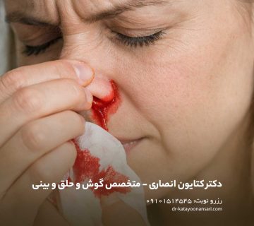 خوندماغ، خونریزی بینی یا نام علمی آن اپیستاکسی (Epistaxis)