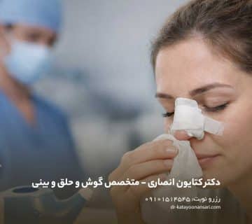 آبریزش بینی بعد از عمل بینی