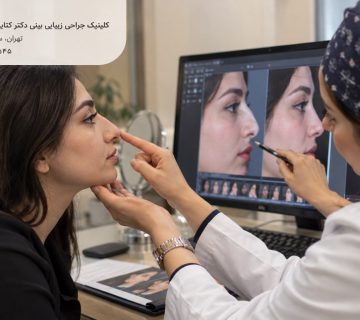 مشاوره عمل بینی استخوانی و قوزدار؛ بررسی فرم و قوز بینی بیمار توسط جراح برای انتخاب نتیجه طبیعی یا نیمه‌فانتزی در کلینیک دکتر کتایون انصاری