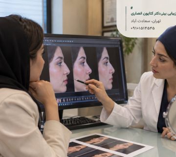 مشاوره انتخاب مدل عمل بینی طبیعی، نیمه‌فانتزی یا فانتزی در کلینیک دکتر کتایون انصاری؛ بررسی تصاویر فرم‌های مختلف بینی برای انتخاب مدل متناسب با صورت